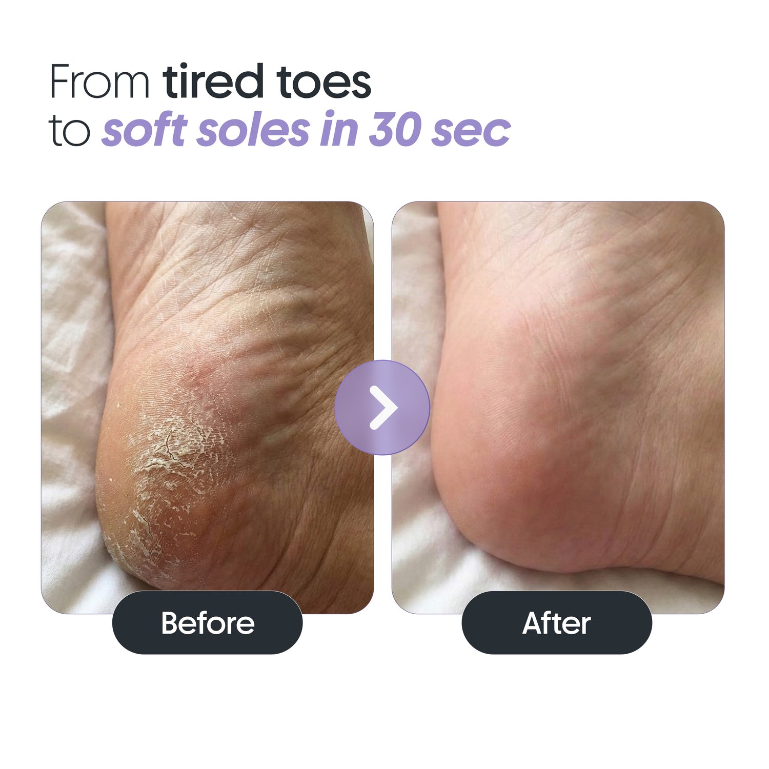 Instant Pedicure Spray