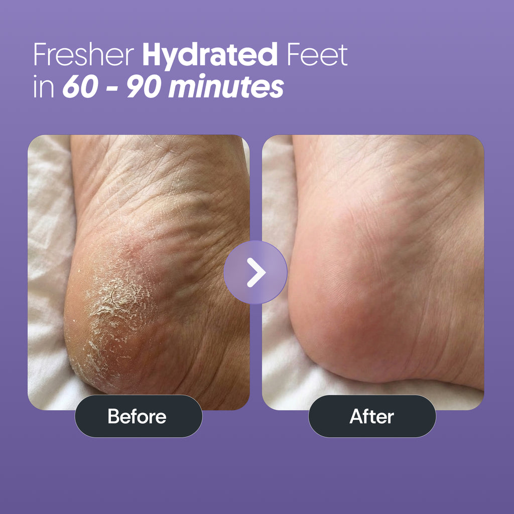 Foot Peel Mask - Pack of 2