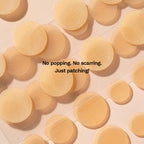 Pimple Patches (30 Patches)