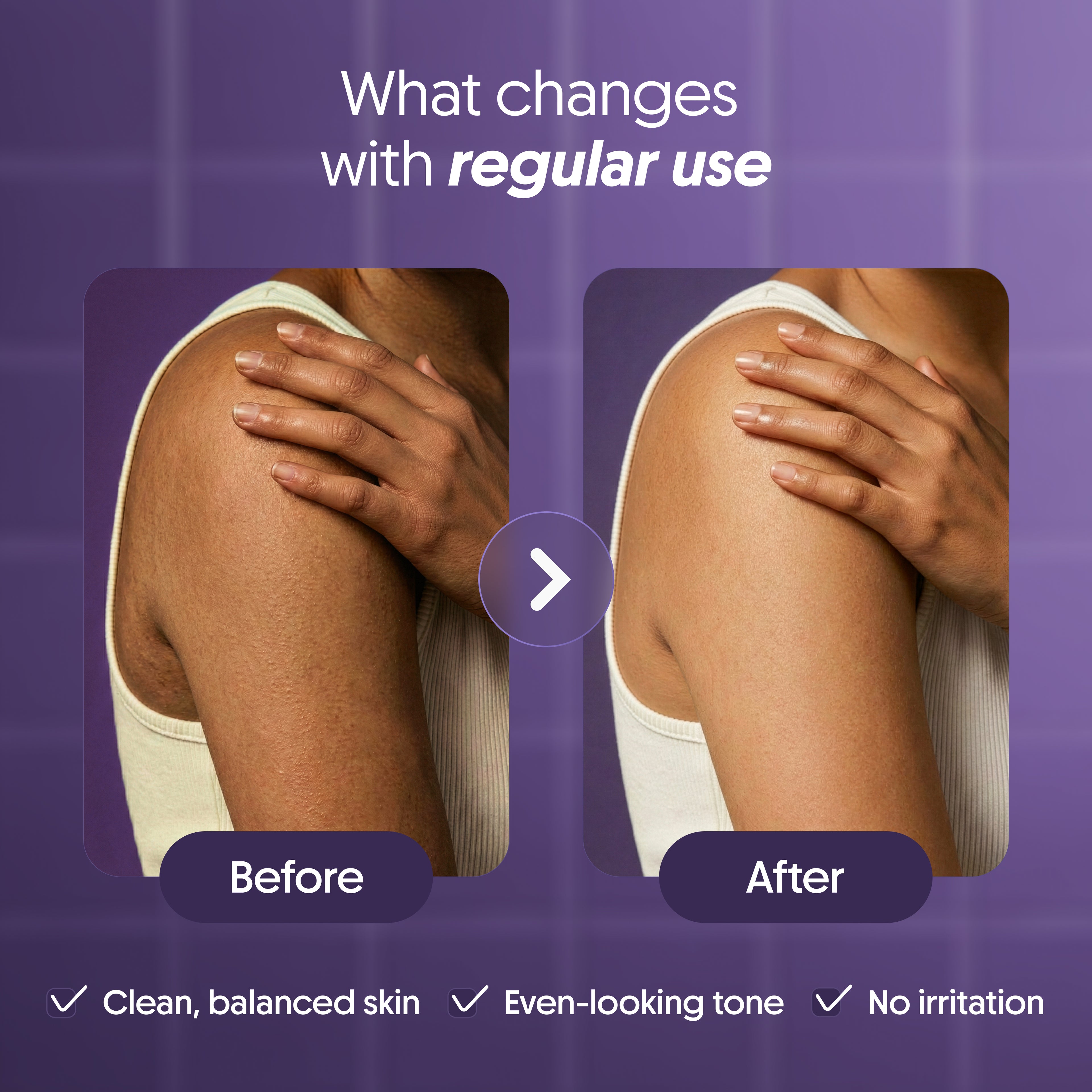 Kojic Acid Soap
