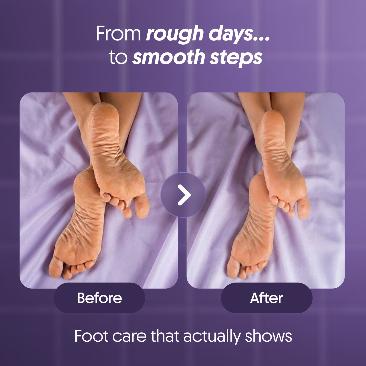 Urea & Natural AHAs Foot Cream