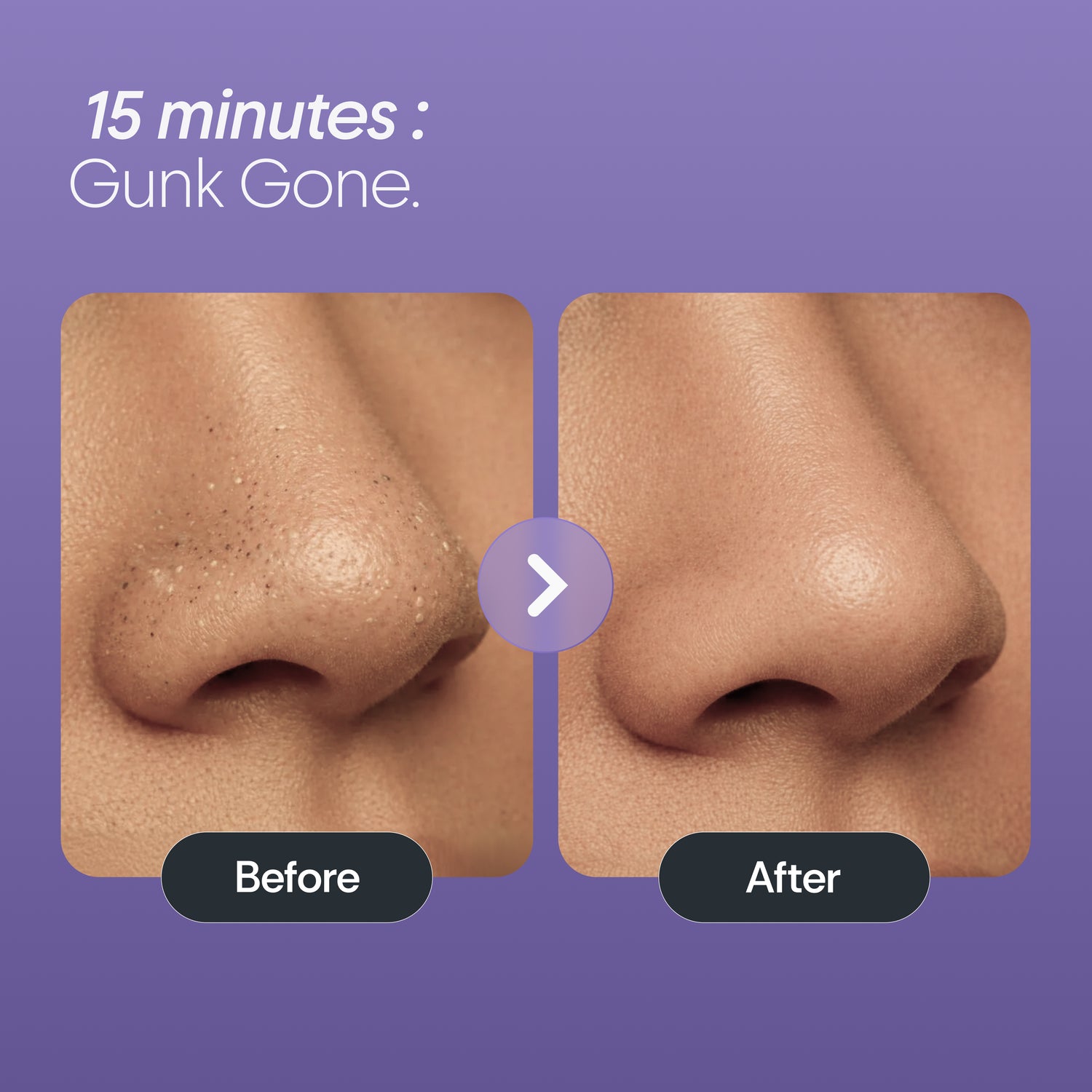 Bamboo Charcoal Nose Strips (3N)