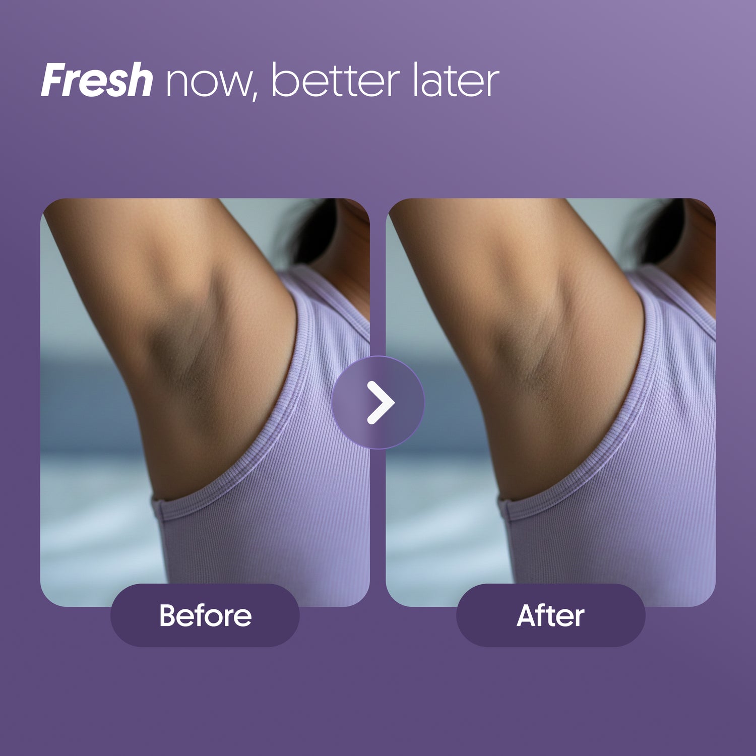 4% AHA BHA Underarm Roll-On - Aqua