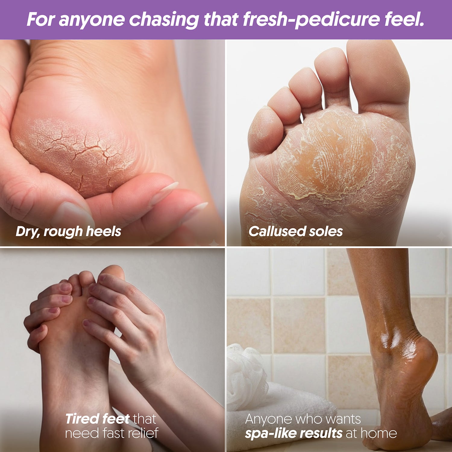 FURR Foot Rejuvenation Kit