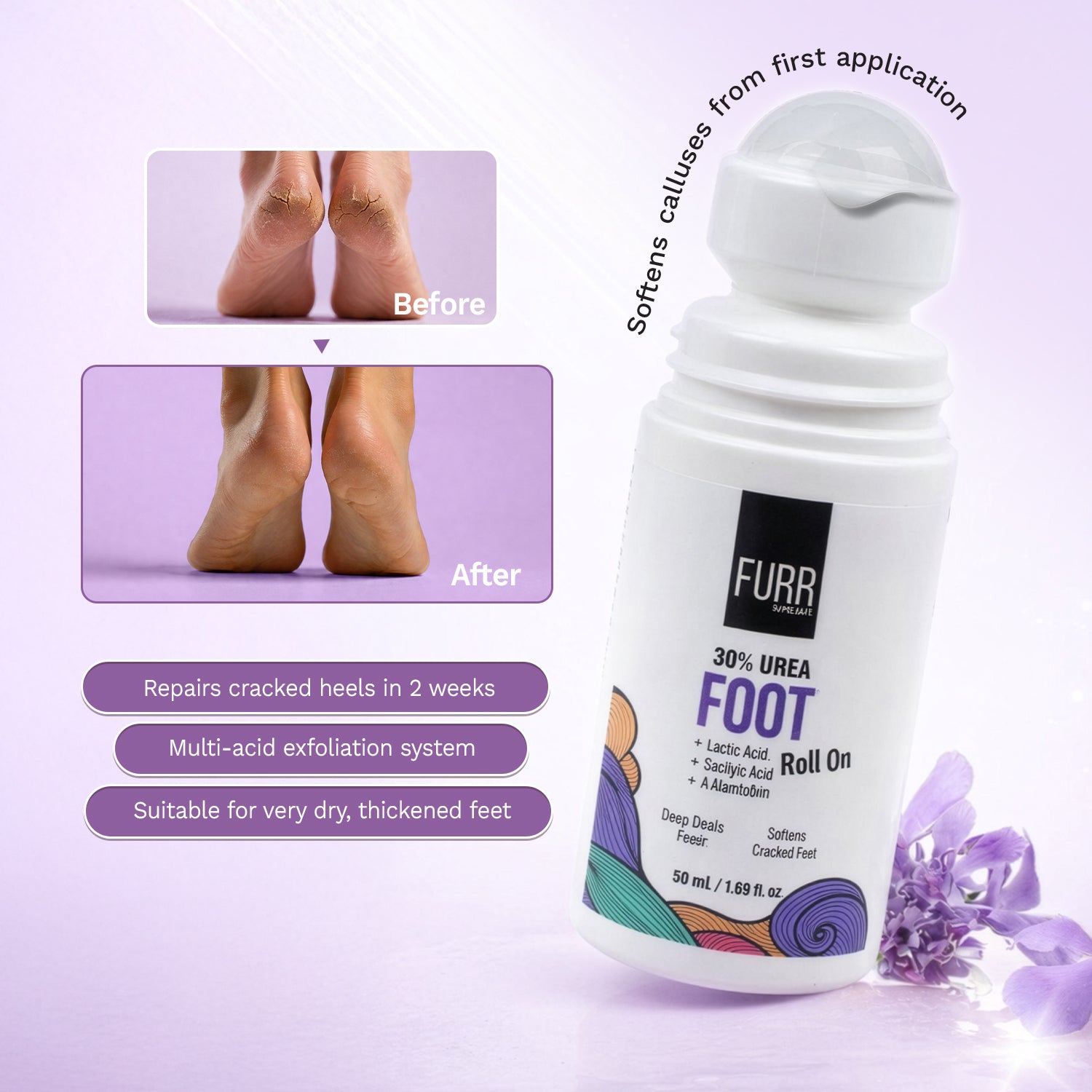 30% Urea Foot Roll-On