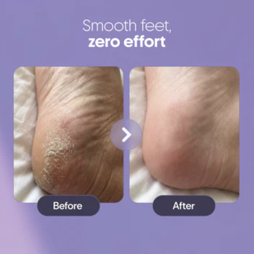 HEEL REPAIR KIT