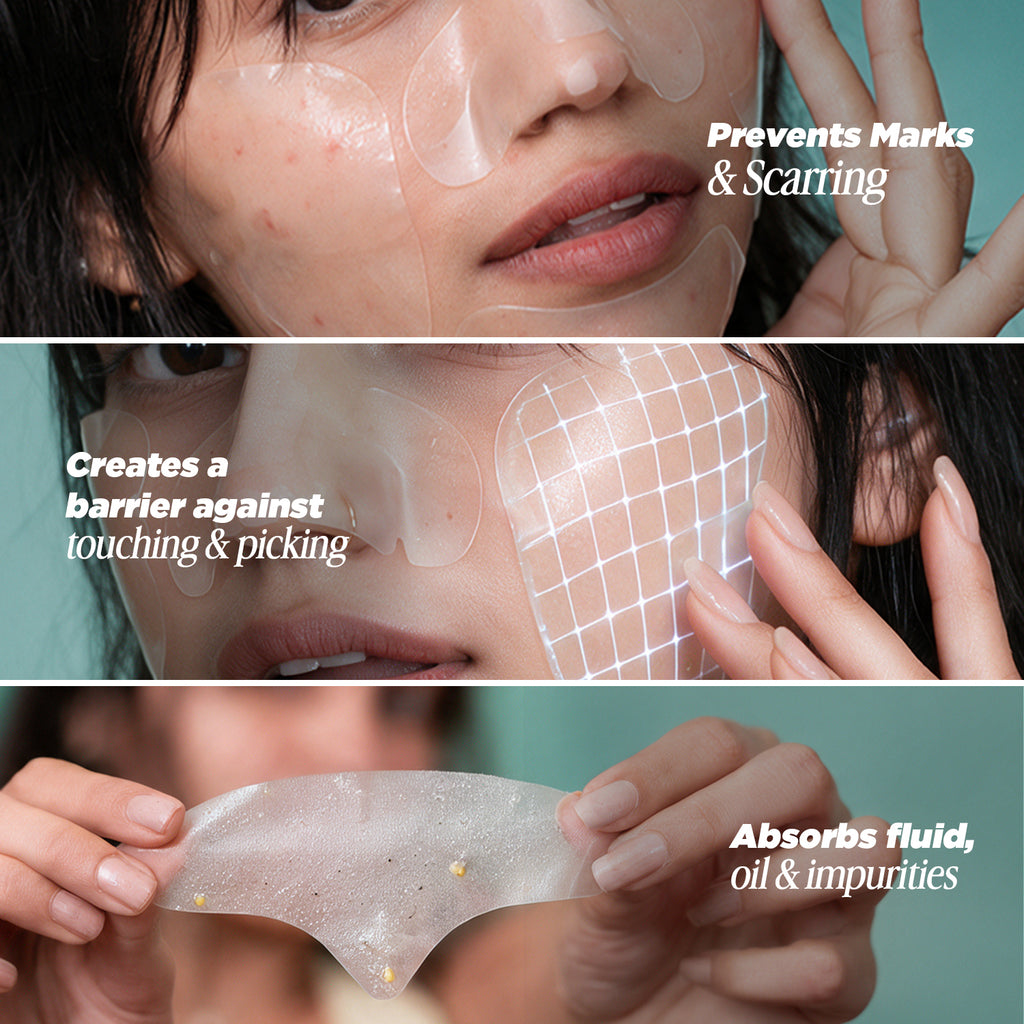 5-in-1 Full Face Pimple Patch