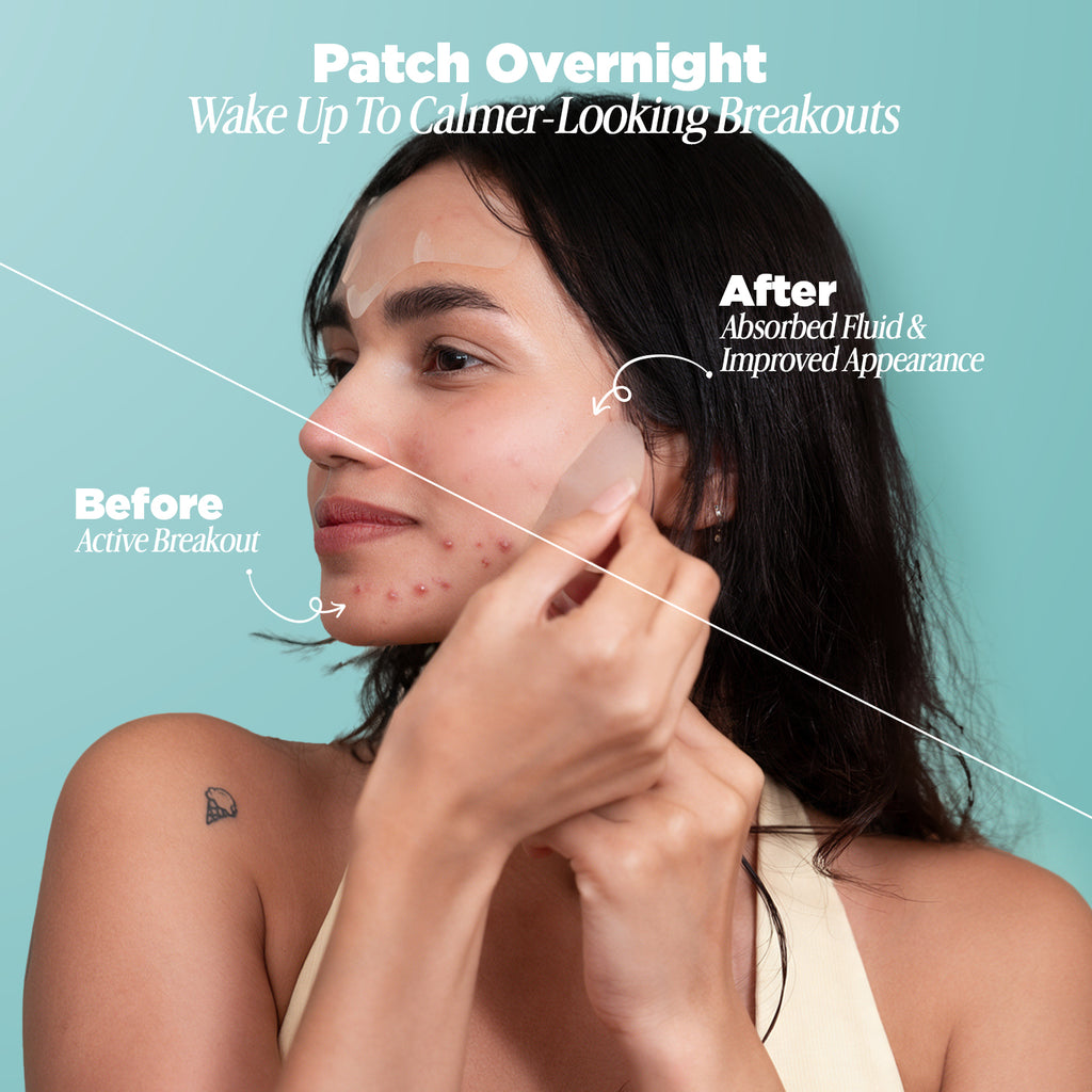 5-in-1 Full Face Pimple Patch